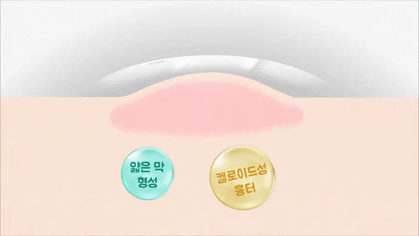 [의료기기] 시카슈어 겔 15g 상세페이지 4